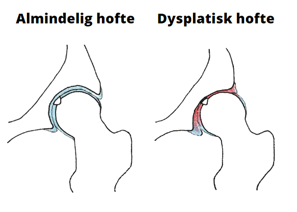 Hoftedysplasi